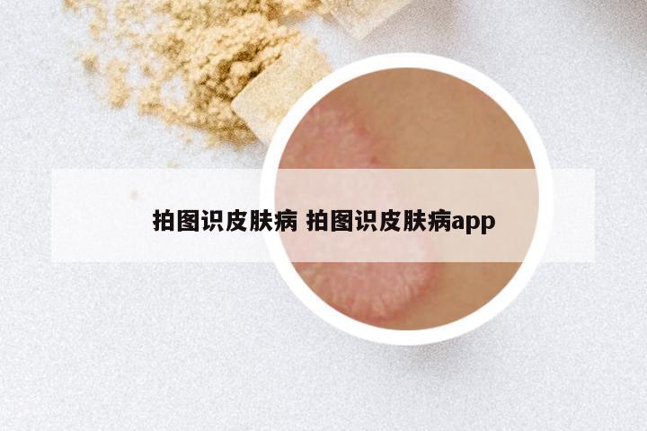 拍图识皮肤病 拍图识皮肤病app