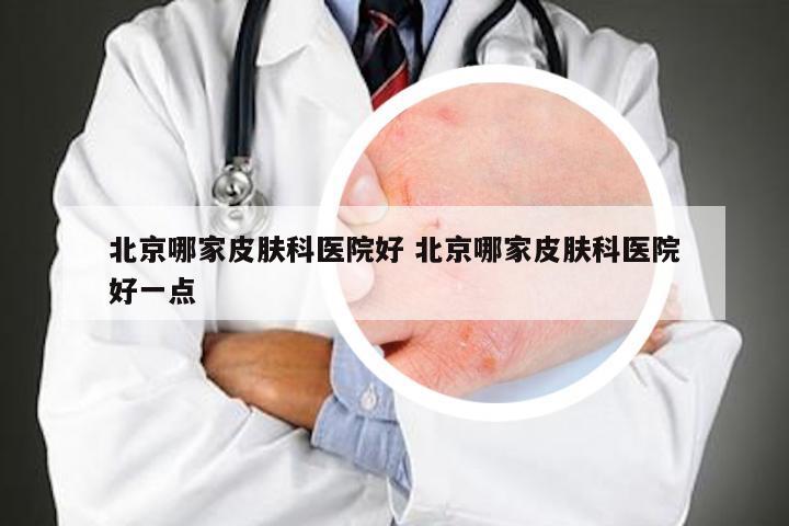 北京哪家皮肤科医院好 北京哪家皮肤科医院好一点