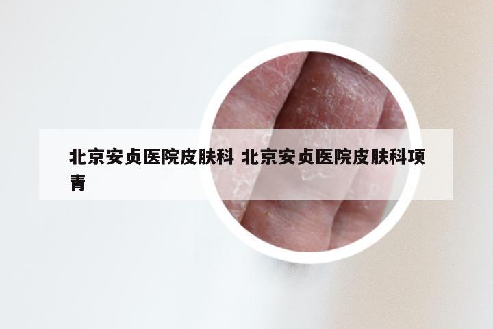 北京安贞医院皮肤科 北京安贞医院皮肤科项青