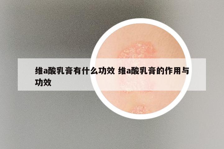 维a酸乳膏有什么功效 维a酸乳膏的作用与功效
