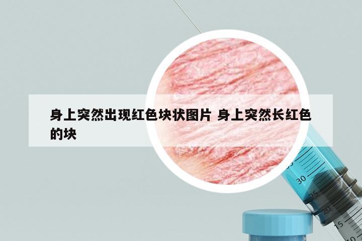 身上突然出现红色块状图片 身上突然长红色的块
