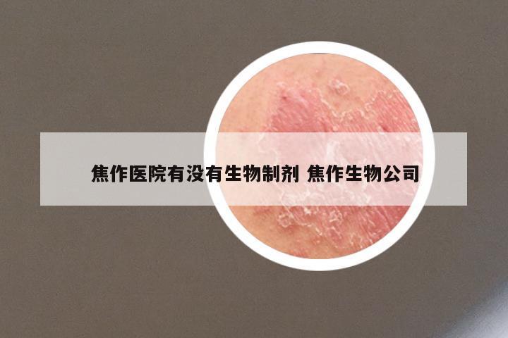 焦作医院有没有生物制剂 焦作生物公司