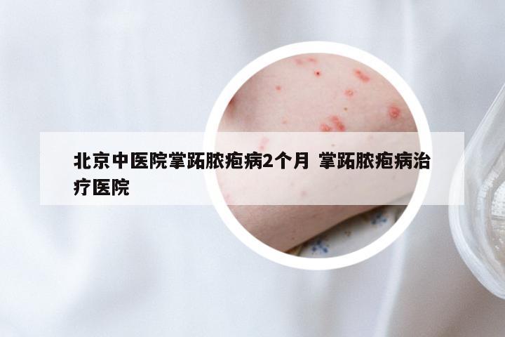 北京中医院掌跖脓疱病2个月 掌跖脓疱病治疗医院