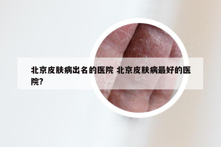 北京皮肤病出名的医院 北京皮肤病最好的医院?