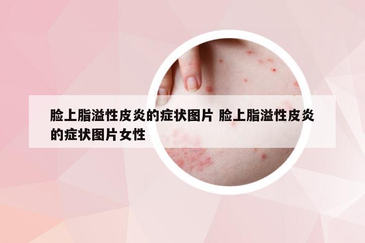 脸上脂溢性皮炎的症状图片 脸上脂溢性皮炎的症状图片女性