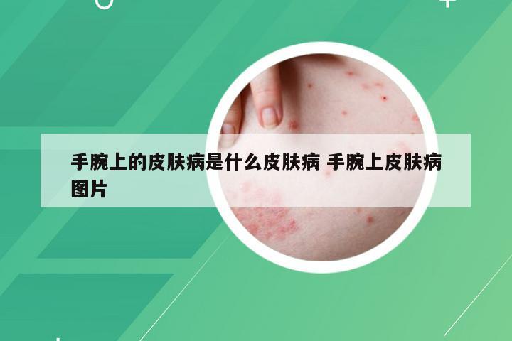 手腕上的皮肤病是什么皮肤病 手腕上皮肤病图片