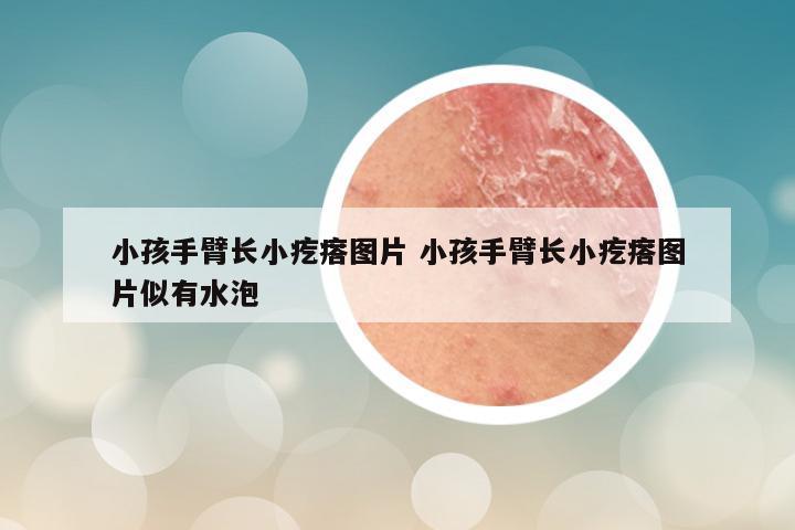 小孩手臂长小疙瘩图片 小孩手臂长小疙瘩图片似有水泡