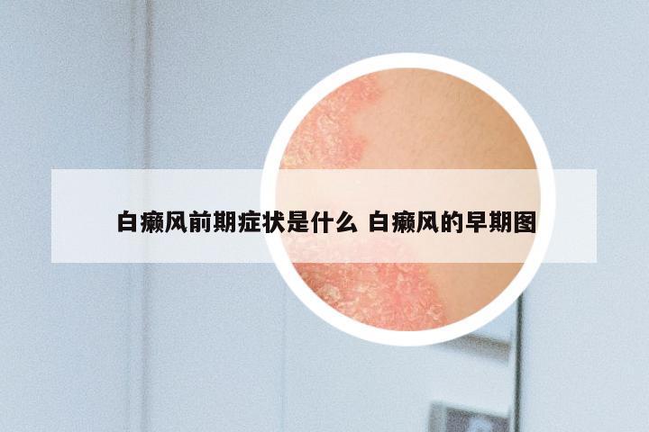 白癞风前期症状是什么 白癞风的早期图