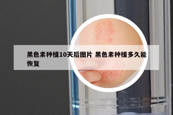 黑色素种植10天后图片 黑色素种植多久能恢复