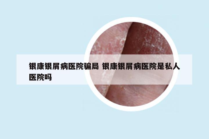 银康银屑病医院骗局 银康银屑病医院是私人医院吗