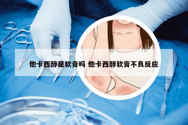 他卡西醇是软膏吗 他卡西醇软膏不良反应