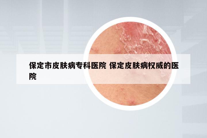 保定市皮肤病专科医院 保定皮肤病权威的医院