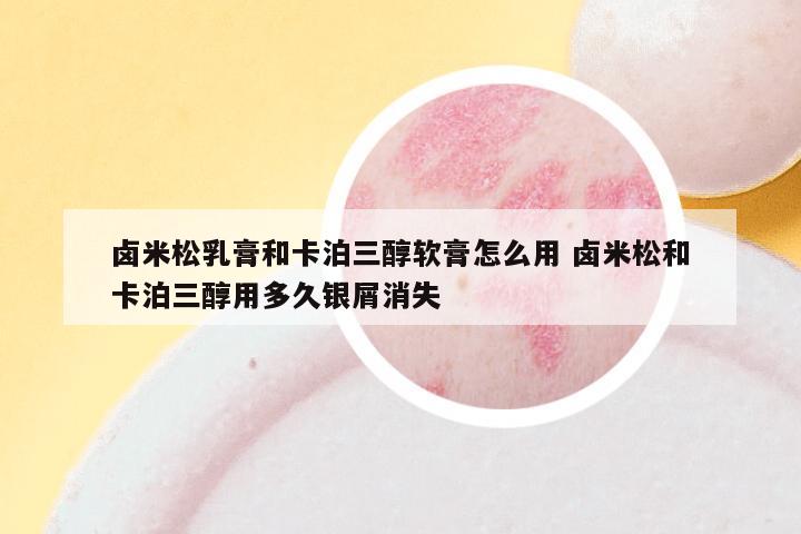 卤米松乳膏和卡泊三醇软膏怎么用 卤米松和卡泊三醇用多久银屑消失