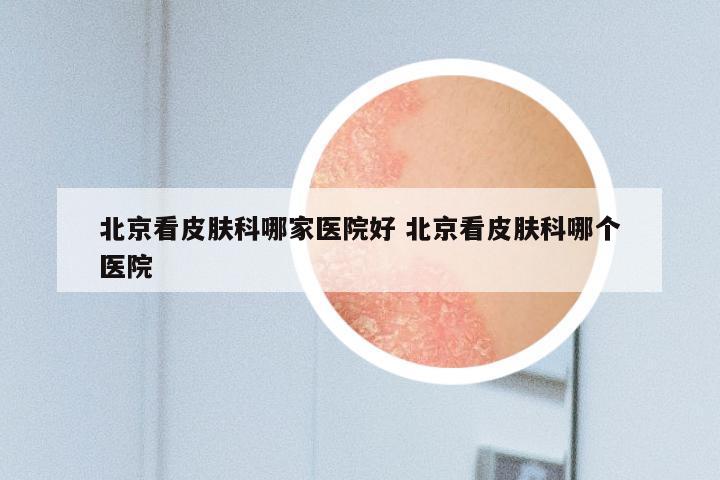 北京看皮肤科哪家医院好 北京看皮肤科哪个医院