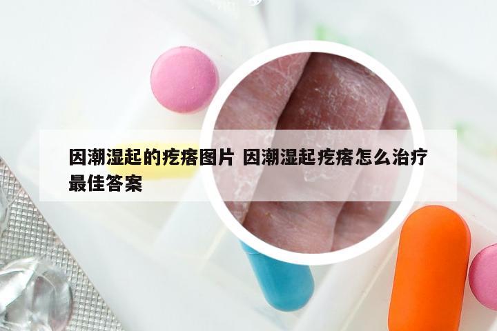 因潮湿起的疙瘩图片 因潮湿起疙瘩怎么治疗最佳答案