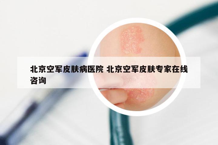 北京空军皮肤病医院 北京空军皮肤专家在线咨询