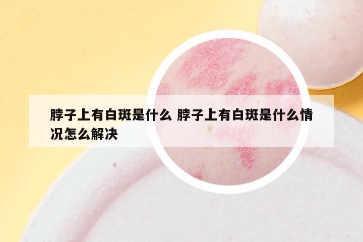 脖子上有白斑是什么 脖子上有白斑是什么情况怎么解决