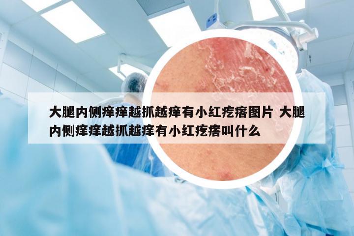 大腿内侧痒痒越抓越痒有小红疙瘩图片 大腿内侧痒痒越抓越痒有小红疙瘩叫什么