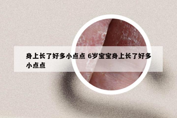 身上长了好多小点点 6岁宝宝身上长了好多小点点