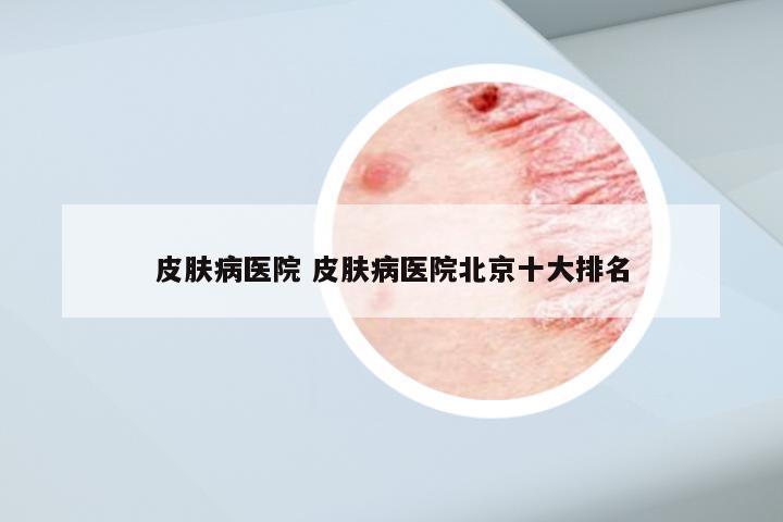 皮肤病医院 皮肤病医院北京十大排名