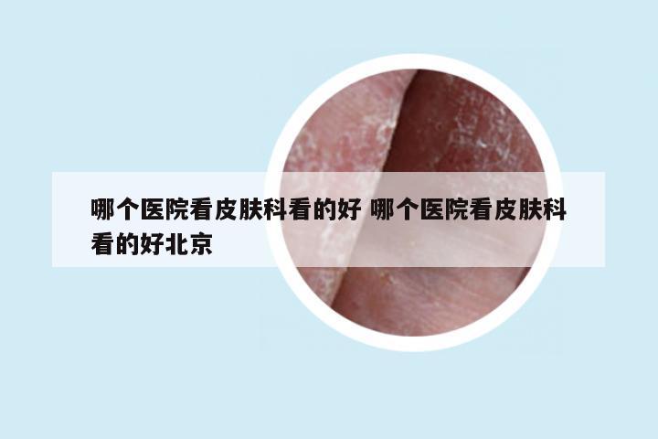 哪个医院看皮肤科看的好 哪个医院看皮肤科看的好北京