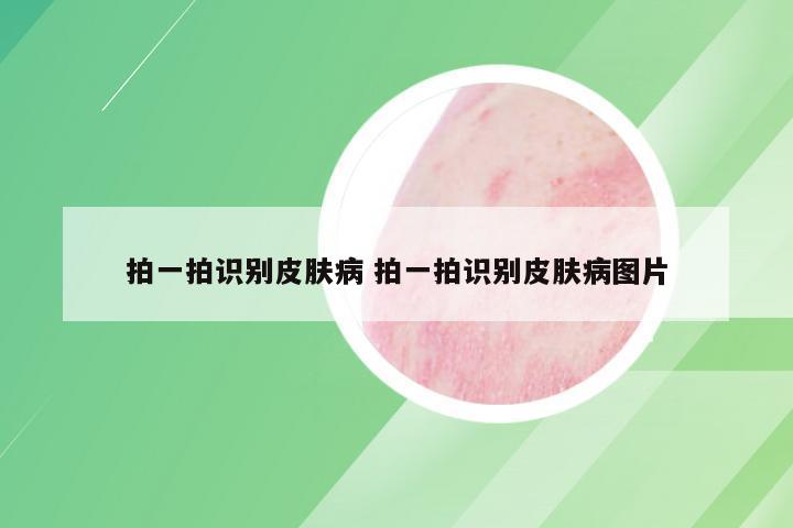 拍一拍识别皮肤病 拍一拍识别皮肤病图片