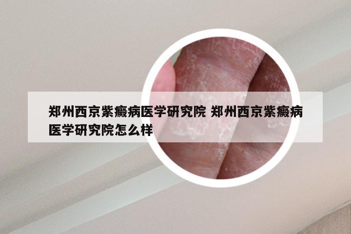 郑州西京紫癜病医学研究院 郑州西京紫癜病医学研究院怎么样