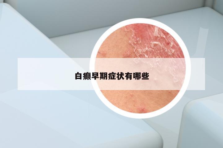 白癫早期症状有哪些