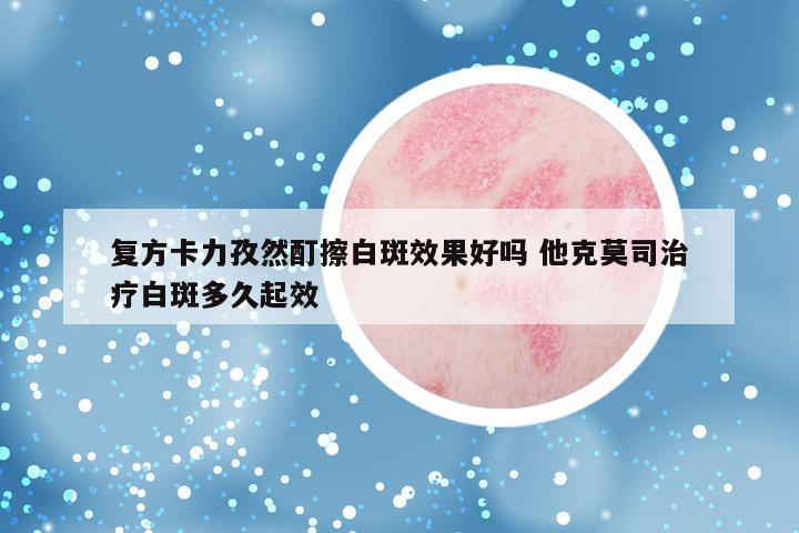 复方卡力孜然酊擦白斑效果好吗 他克莫司治疗白斑多久起效