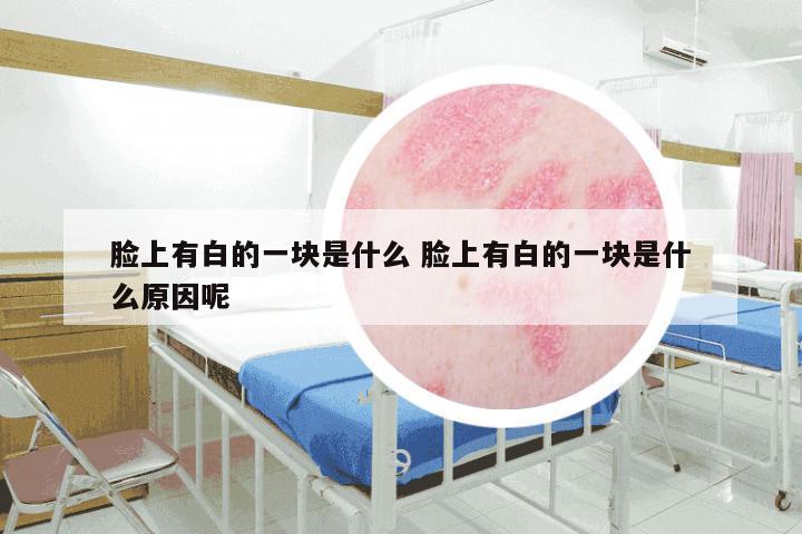 脸上有白的一块是什么 脸上有白的一块是什么原因呢