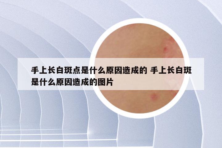 手上长白斑点是什么原因造成的 手上长白斑是什么原因造成的图片