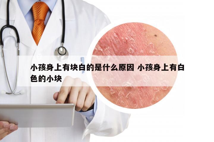 小孩身上有块白的是什么原因 小孩身上有白色的小块