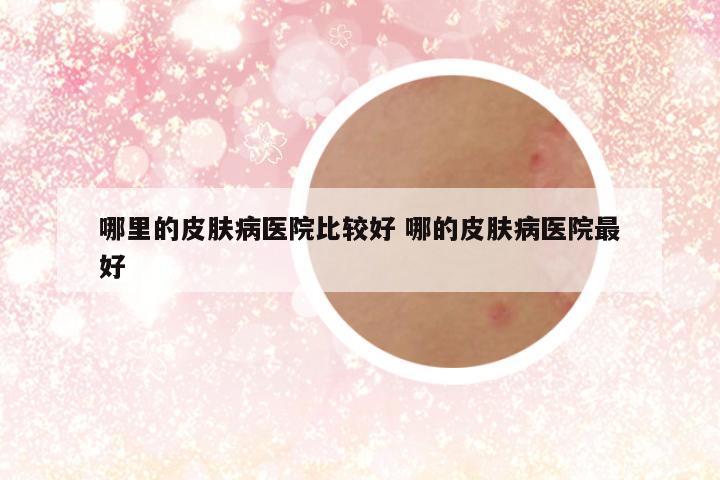 哪里的皮肤病医院比较好 哪的皮肤病医院最好