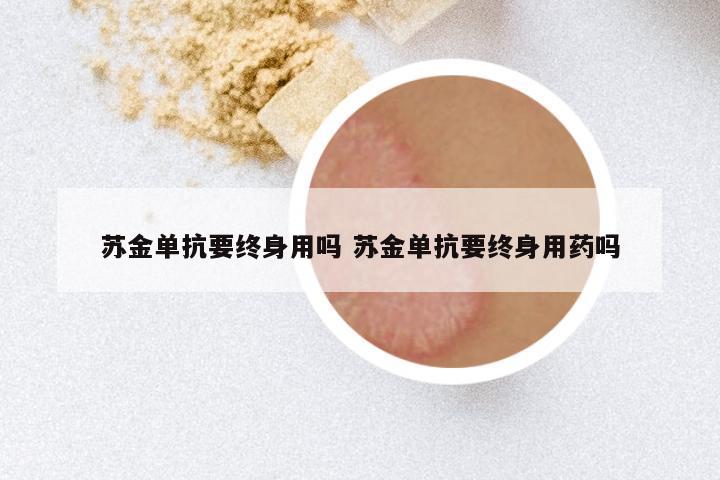 苏金单抗要终身用吗 苏金单抗要终身用药吗