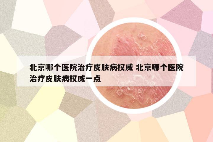 北京哪个医院治疗皮肤病权威 北京哪个医院治疗皮肤病权威一点