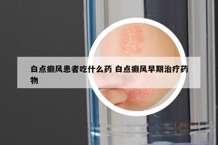 白点癫风患者吃什么药 白点癫风早期治疗药物