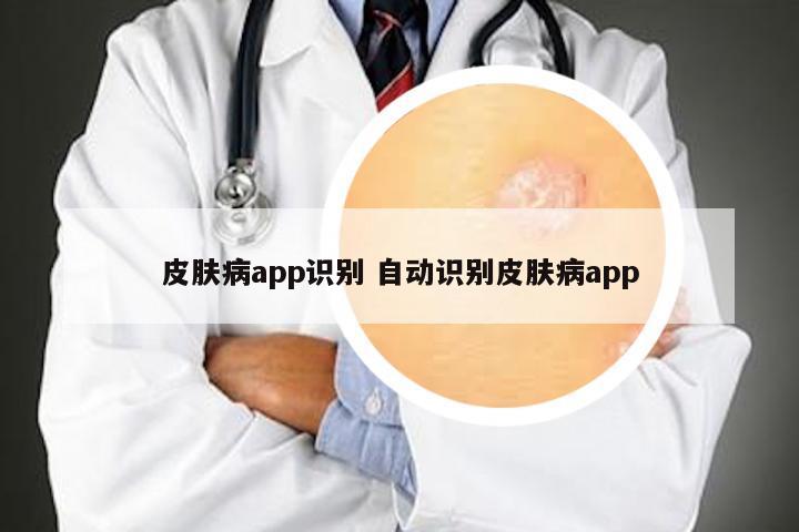 皮肤病app识别 自动识别皮肤病app