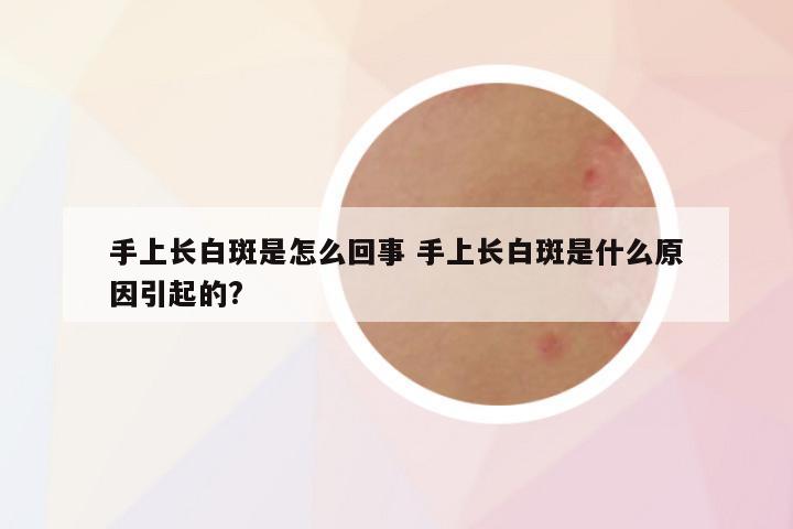 手上长白斑是怎么回事 手上长白斑是什么原因引起的?