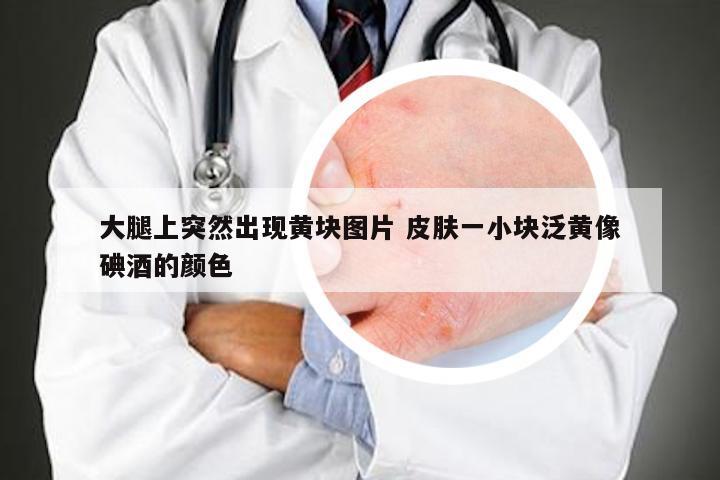 大腿上突然出现黄块图片 皮肤一小块泛黄像碘酒的颜色