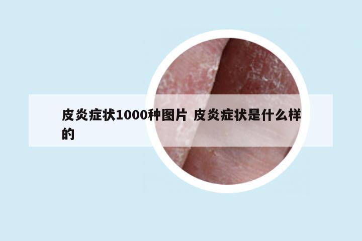 皮炎症状1000种图片 皮炎症状是什么样的