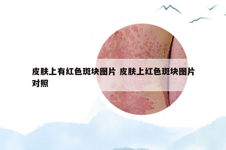 皮肤上有红色斑块图片 皮肤上红色斑块图片对照