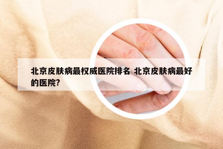 北京皮肤病最权威医院排名 北京皮肤病最好的医院?