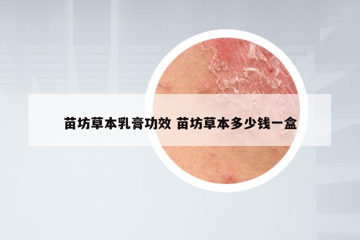苗坊草本乳膏功效 苗坊草本多少钱一盒