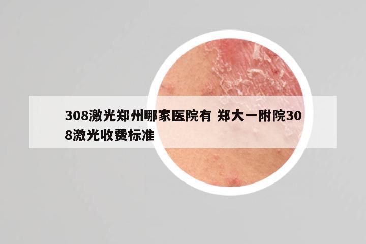 308激光郑州哪家医院有 郑大一附院308激光收费标准