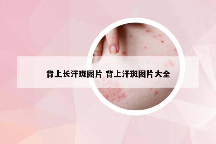 背上长汗斑图片 背上汗斑图片大全