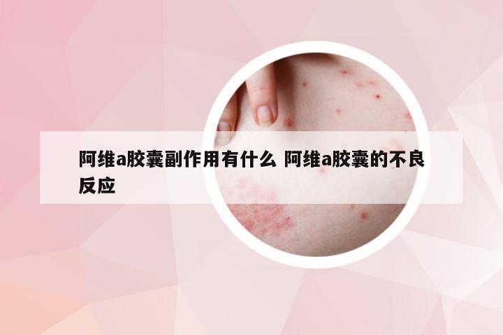 阿维a胶囊副作用有什么 阿维a胶囊的不良反应