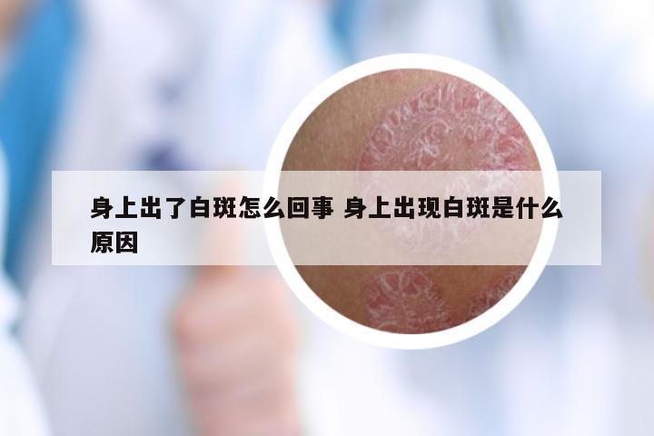 身上出了白斑怎么回事 身上出现白斑是什么原因