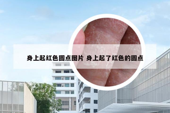 身上起红色圆点图片 身上起了红色的圆点