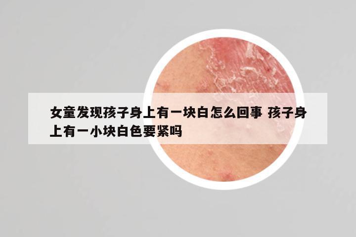 女童发现孩子身上有一块白怎么回事 孩子身上有一小块白色要紧吗