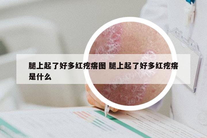 腿上起了好多红疙瘩图 腿上起了好多红疙瘩是什么